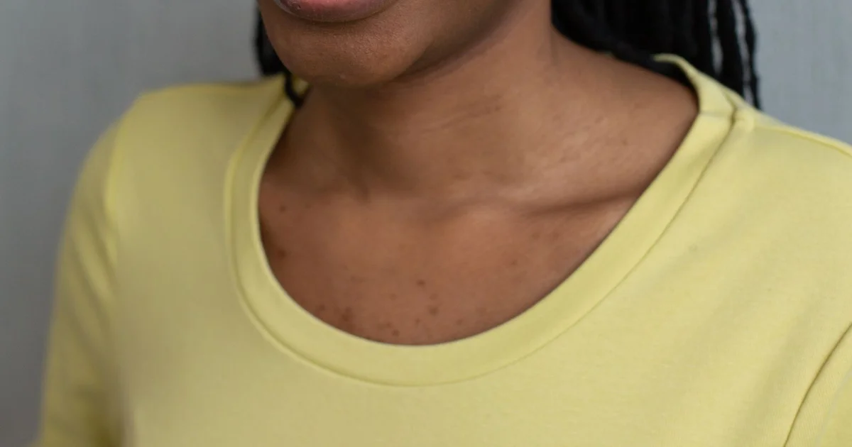 Early Orthodontic Treatment for Children - When to Act and When to Wait